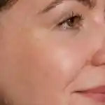 462x462_MM_Pigmentation.jpg