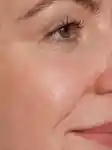 462x616_MM_Pigmentation.jpg