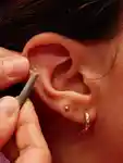 Gold Seed Ear Therapy | By the Melbourne Apothecary image 1