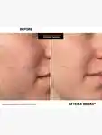 Alternative Image Kate Somerville Exfoli Kate Intensive Treatment