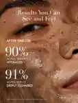 Alternative Image Omorovicza Thermal Cleansing Balm