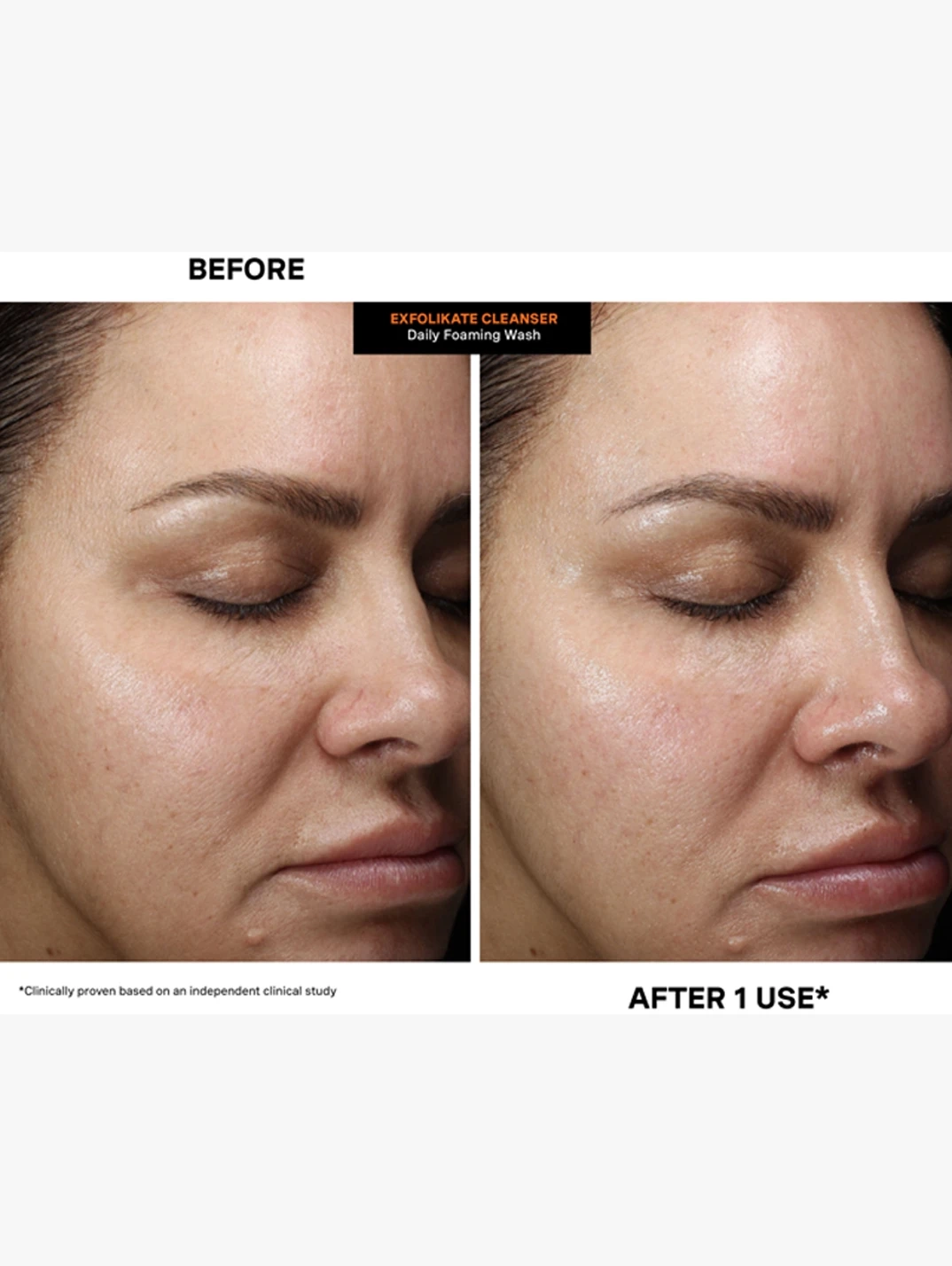 Alternative Image Kate Somerville Exfolikate Cleanser