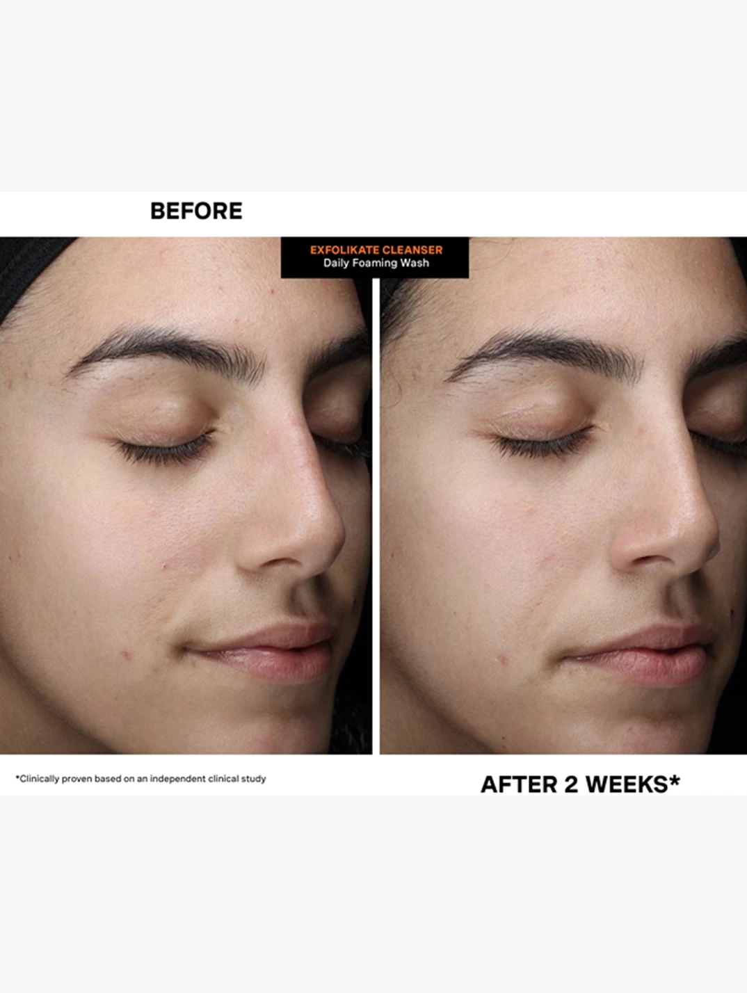 Alternative Image Kate Somerville Exfolikate Cleanser