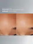 Alternative Image DERMALOGICA Daily Microfoliant40g