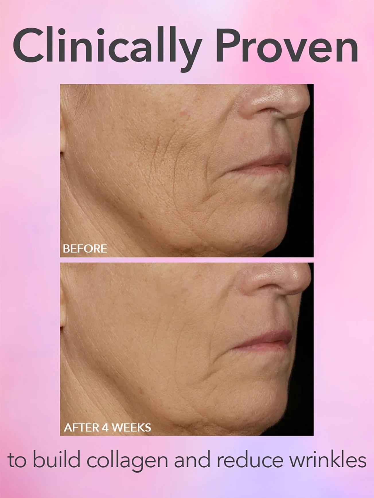 Alternative Image DRDENNISGROSS Spectralite Faceware Pro