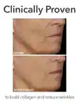Alternative Image DRDENNISGROSS Spectralite Faceware Pro