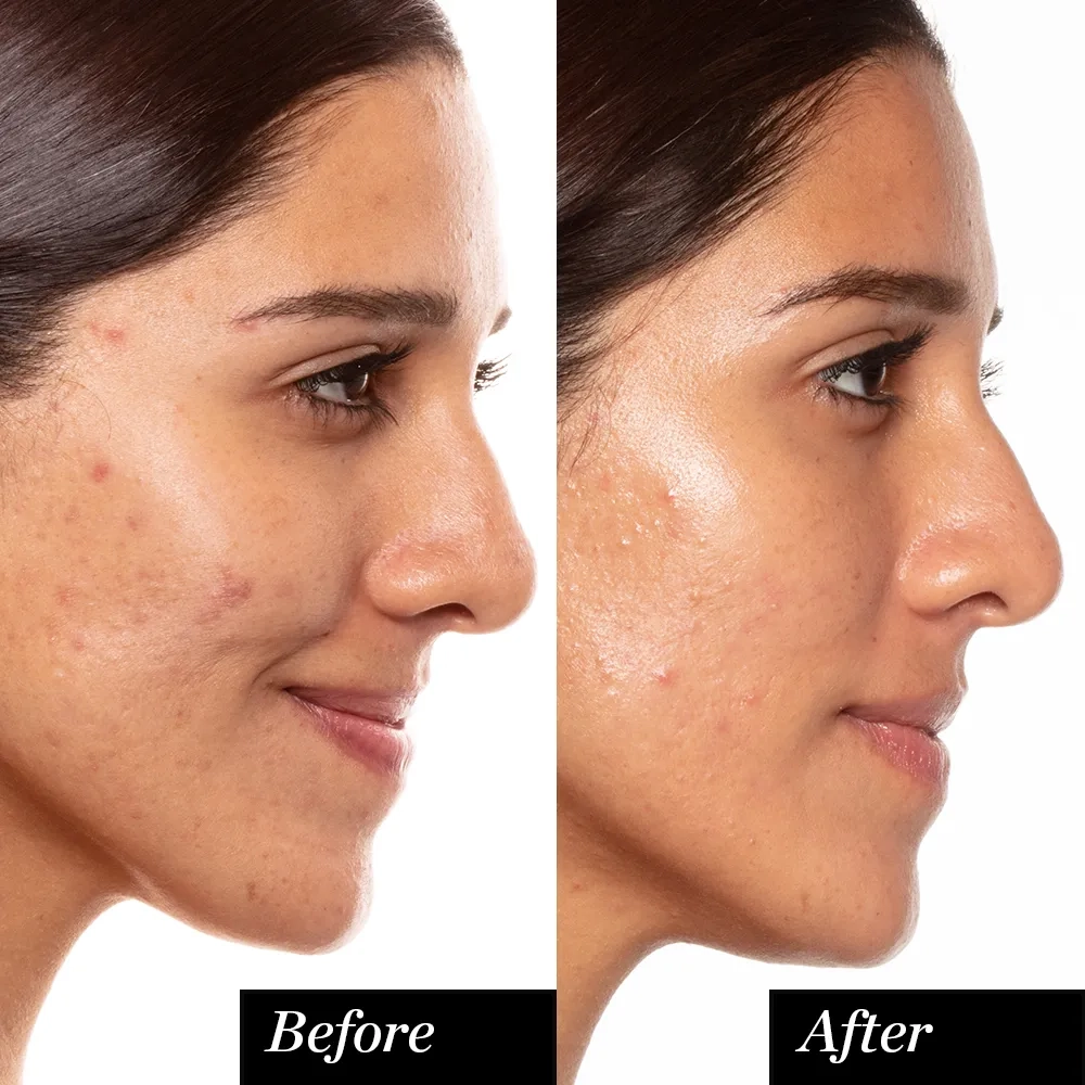 Alternative Image Sunday Riley A+ High Dose Retinoid Serum