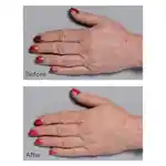 Alternative Image Perricone MD Cold Plasma Plus+ Hand Therapy
