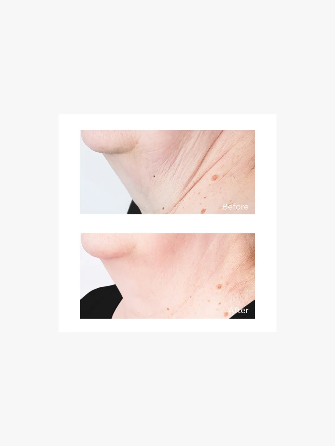 Alternative Image Perricone MD Cold Plasma Plus+ Sub D Neck