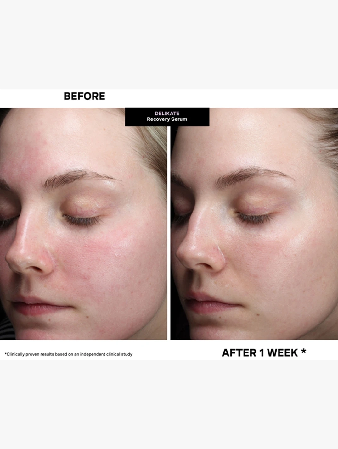 Alternative Image Kate Somerville Deli Kate Recovery Serum