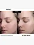 Alternative Image Kate Somerville Deli Kate Recovery Serum