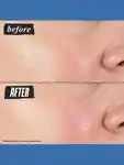 Alternative Image Kiehls Hydro Plumping Serum Concentrate
