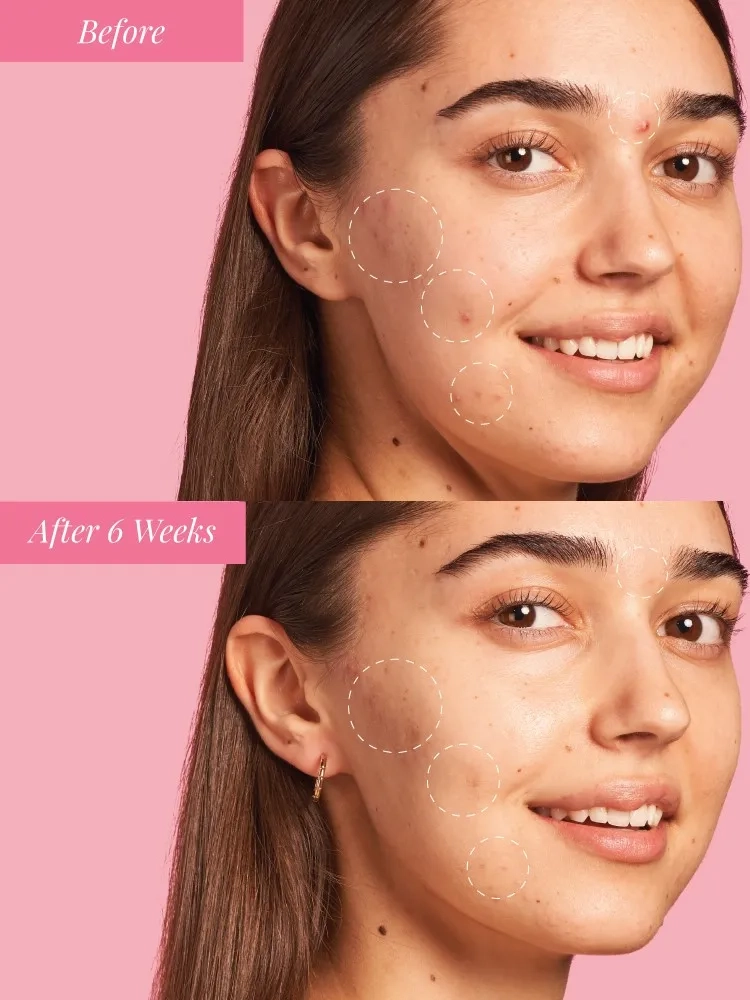 Alternative Image Glow Recipe Watermelon Dew Drops