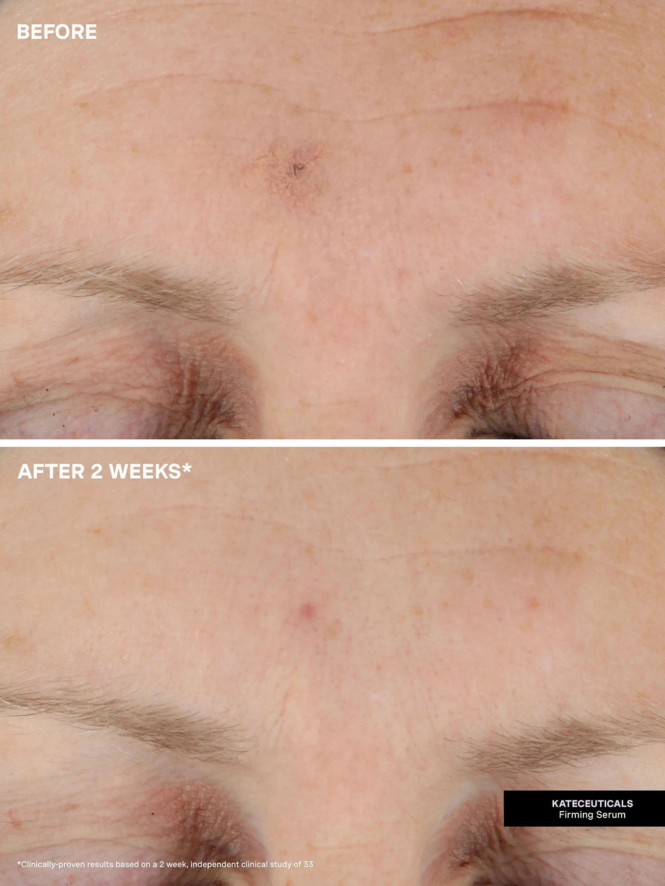 Alternative Image KATESOMERVILLE Kate Ceuticals Firming Serum