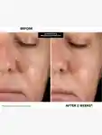 Alternative Image Kate Somerville Kate Ceuticals Resurfacing Overnight Peel