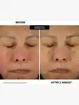 Alternative Image Kate Somerville Kate Ceuticals Total Repair Cream