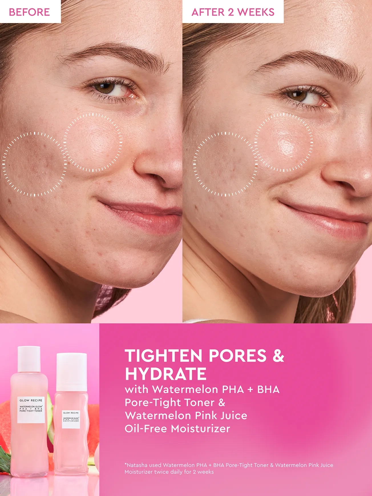Alternative Image Glow Recipe Watermelon Glow PHABHA Toner