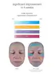 Alternative Image Dermalogica Smart Response Serum