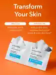 Alternative Image Dr. Dennis Gross Alpha Beta Ultra Gentle Daily Peel