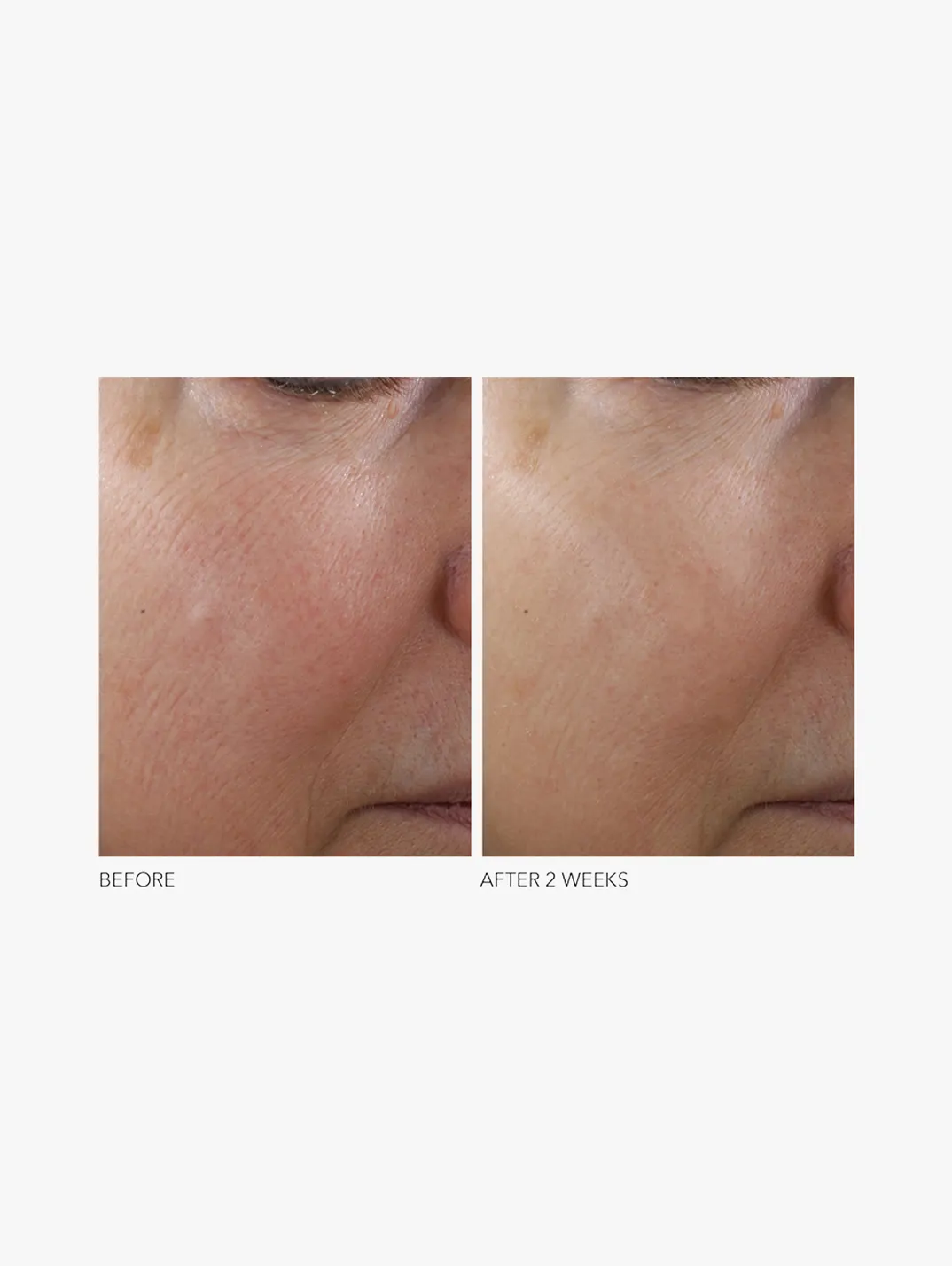 Alternative Image Dr. Dennis Gross Advanced Retinol+ Ferulic Texture Renewal Serum