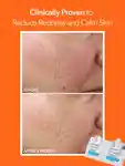 Alternative Image Dr. Dennis Gross Alpha Beta Ultra Gentle Daily Peel