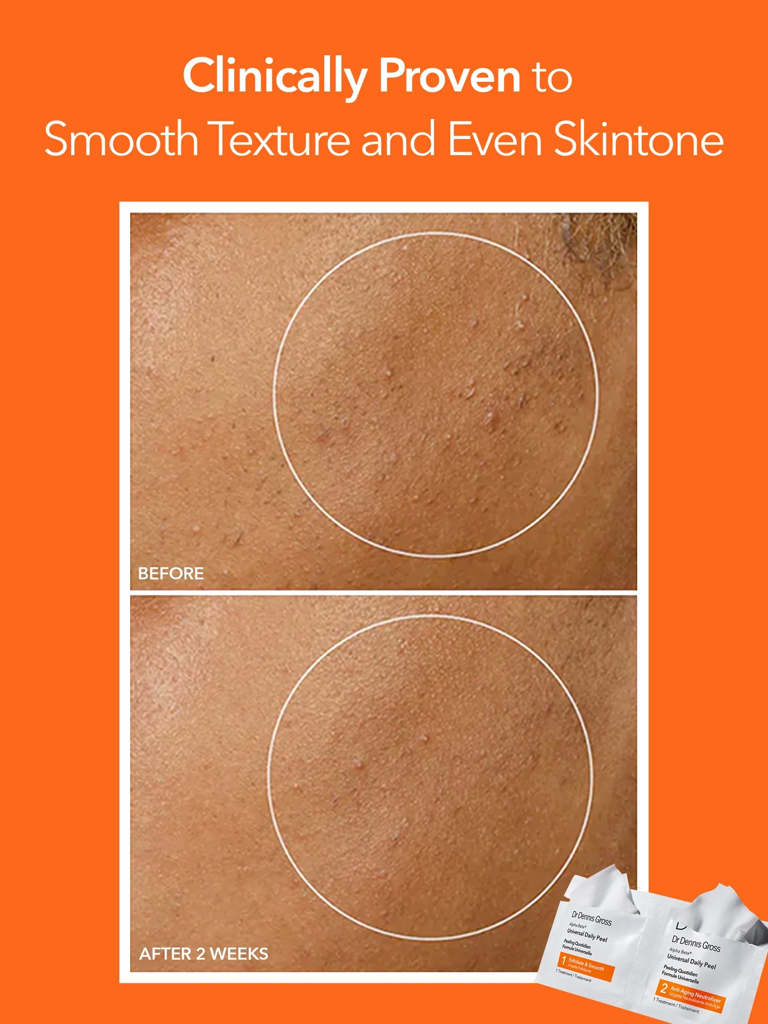 Alternative Image Dr. Dennis Gross Alpha Beta Universal Peel Daily