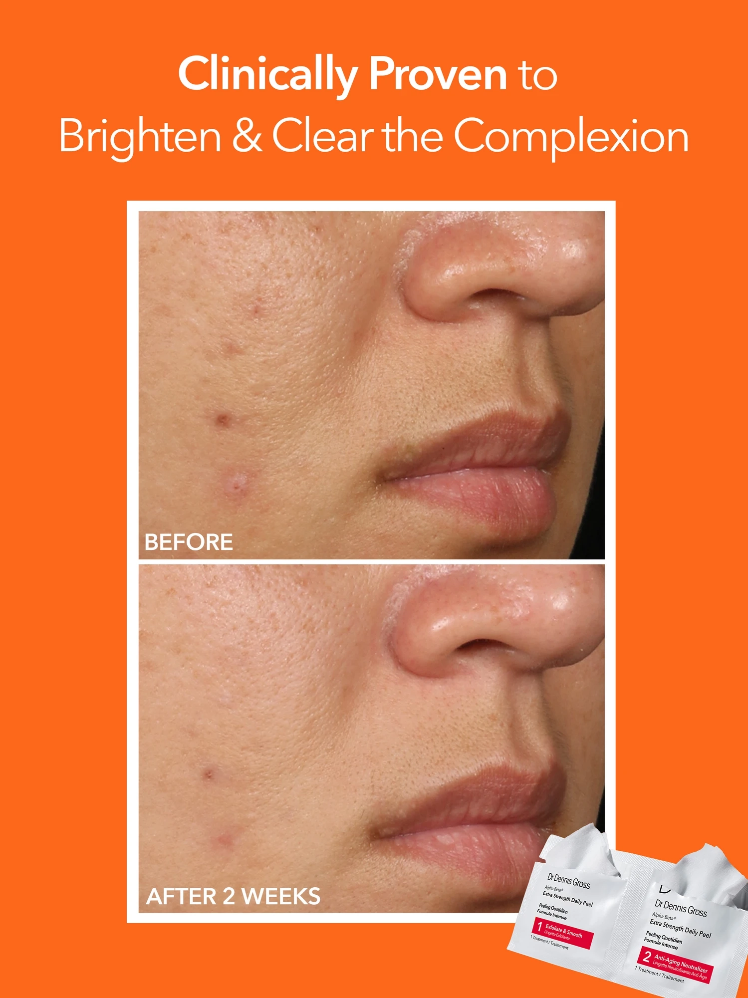 Alternative Image Dr. Dennis Gross Alpha Beta Extra Strength Daily Peel30 App