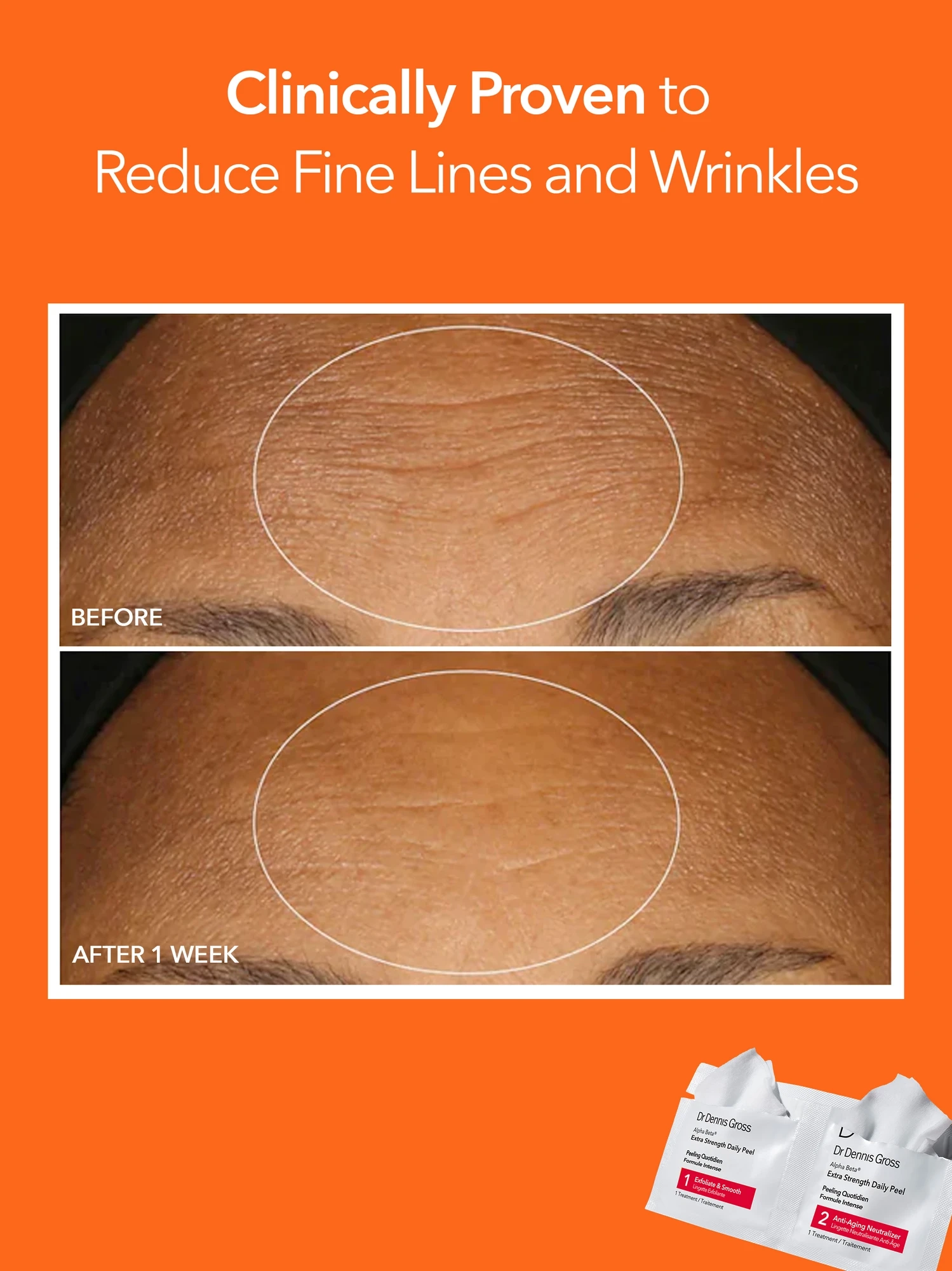 Alternative Image Dr. Dennis Gross Alpha Beta Extra Strength Daily Peel30 App