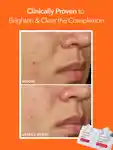 Alternative Image Dr. Dennis Gross Alpha Beta Extra Strength Daily Peel30 App