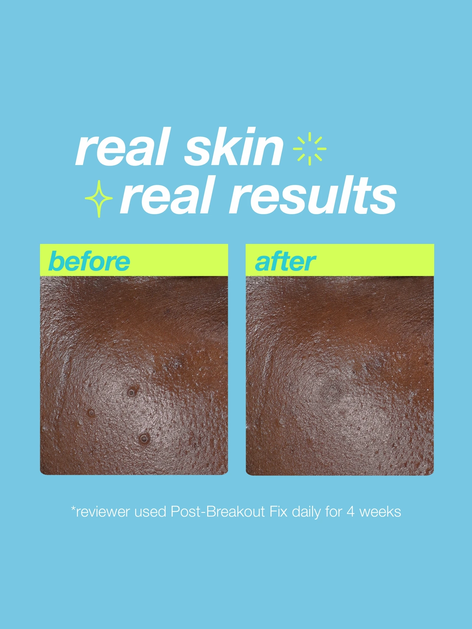 Alternative Image Dermalogica Clear Start Post Breakout Fix