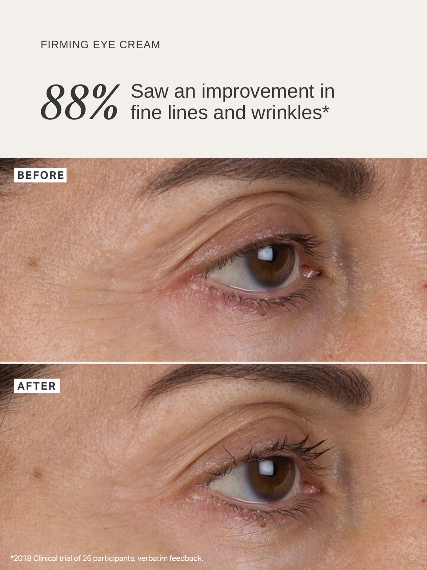 Alternative Image Alpha H Liquid Gold Eye Cream