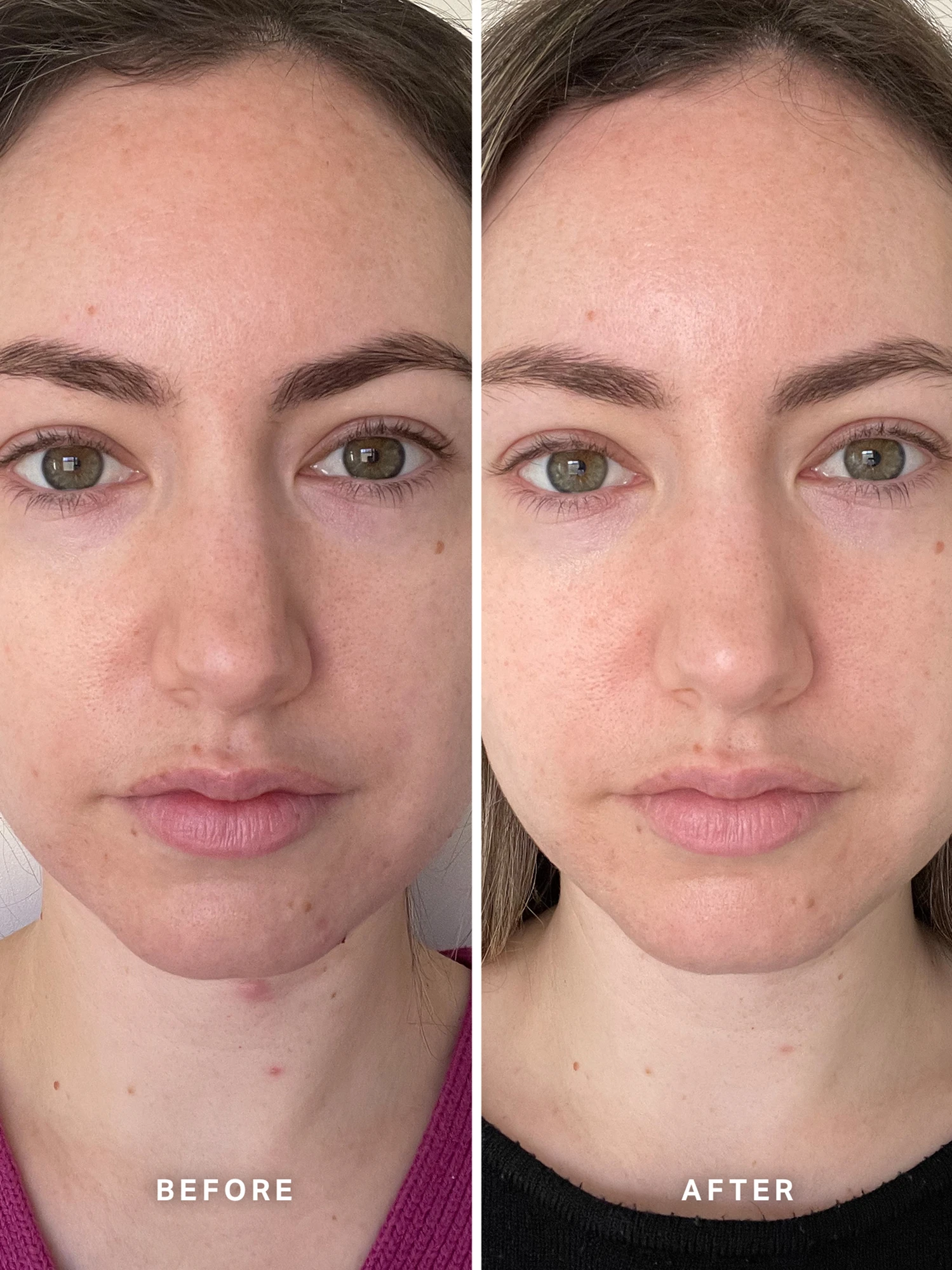 Alternative Image Alpha H Vitamin B Serumwith5% Niacinamide