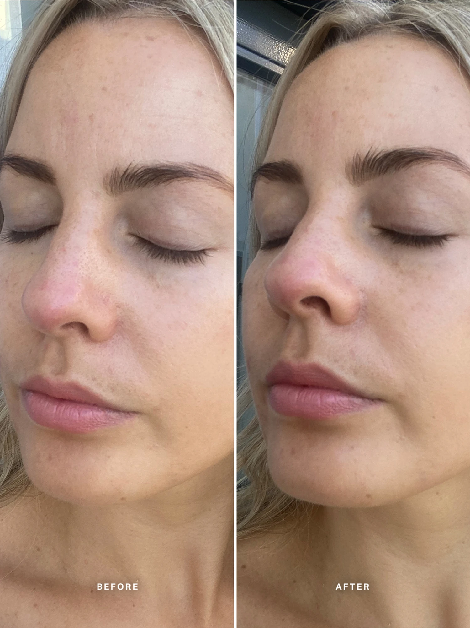 Alternative Image Alpha H Vitamin E Serumwith1% Ceramide Complex