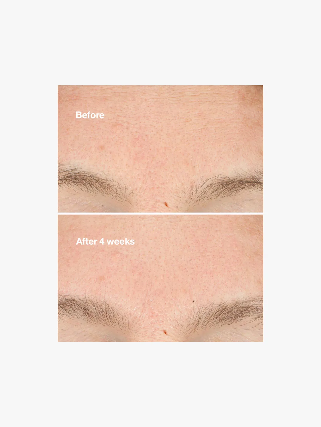 Alternative Image Clinique Clarifying Micro Peel