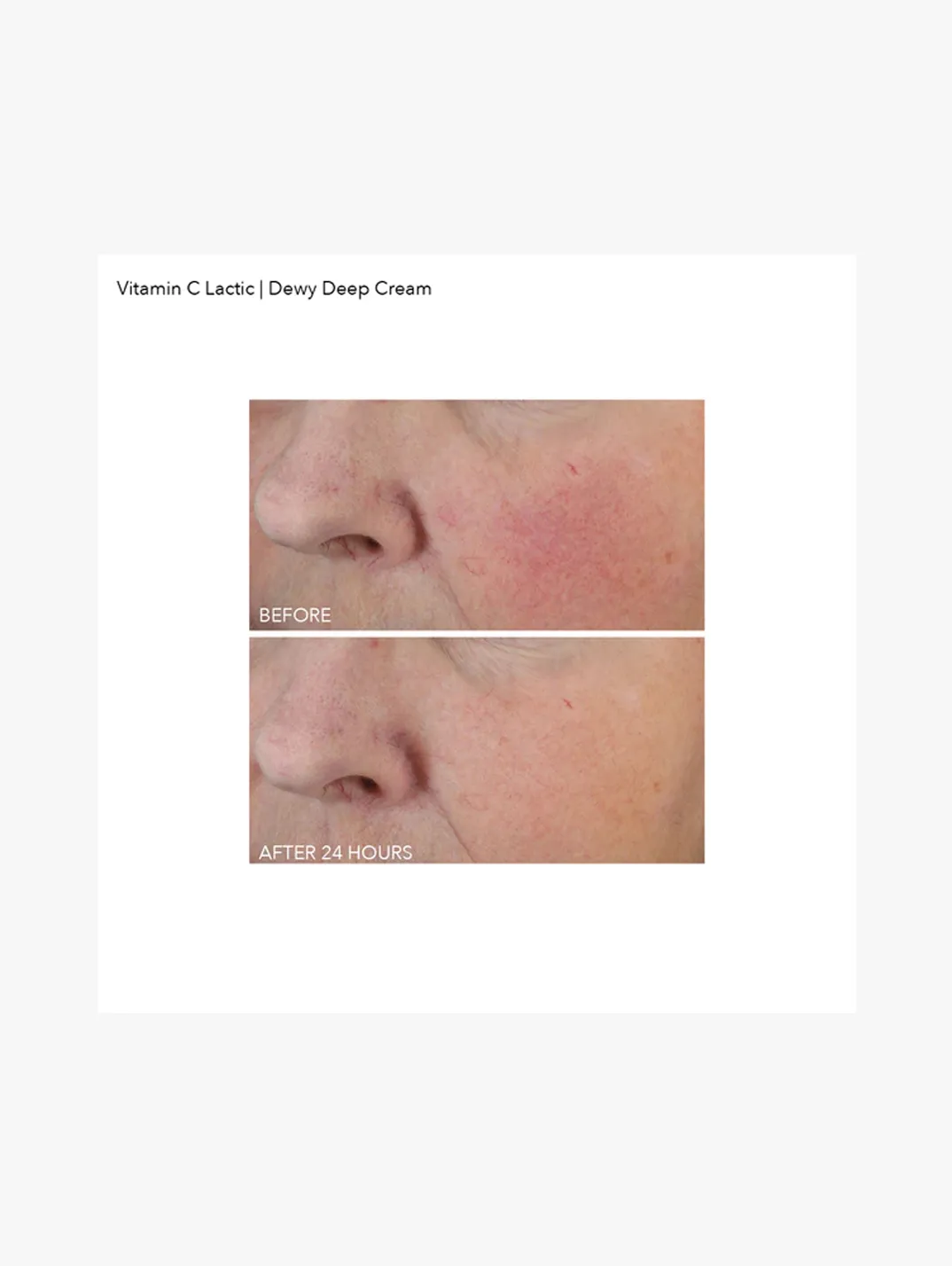 Alternative Image Dr Dennis Gross Vitamin C Dewy Deep Cream