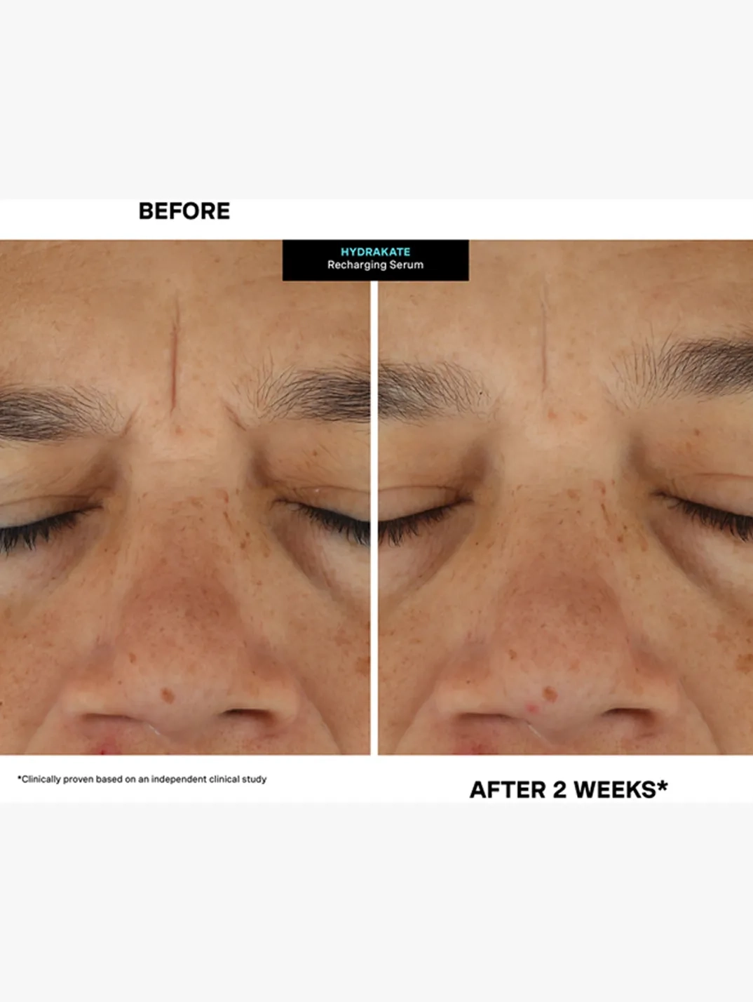 Alternative Image KATEHYDRATIONSERUM