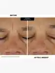Alternative Image KATEHYDRATIONSERUM