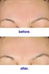 Alternative Image Malin Goetz Retinol Correcting Serum