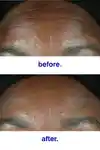 Alternative Image Malin Goetz Retinol Correcting Serum