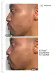 Alternative Image ALLIESOFSKINMULTIACIDRETINOIDFACIAL