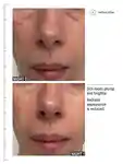 Alternative Image ALLIESOFSKINMULTIACIDRETINOIDFACIAL