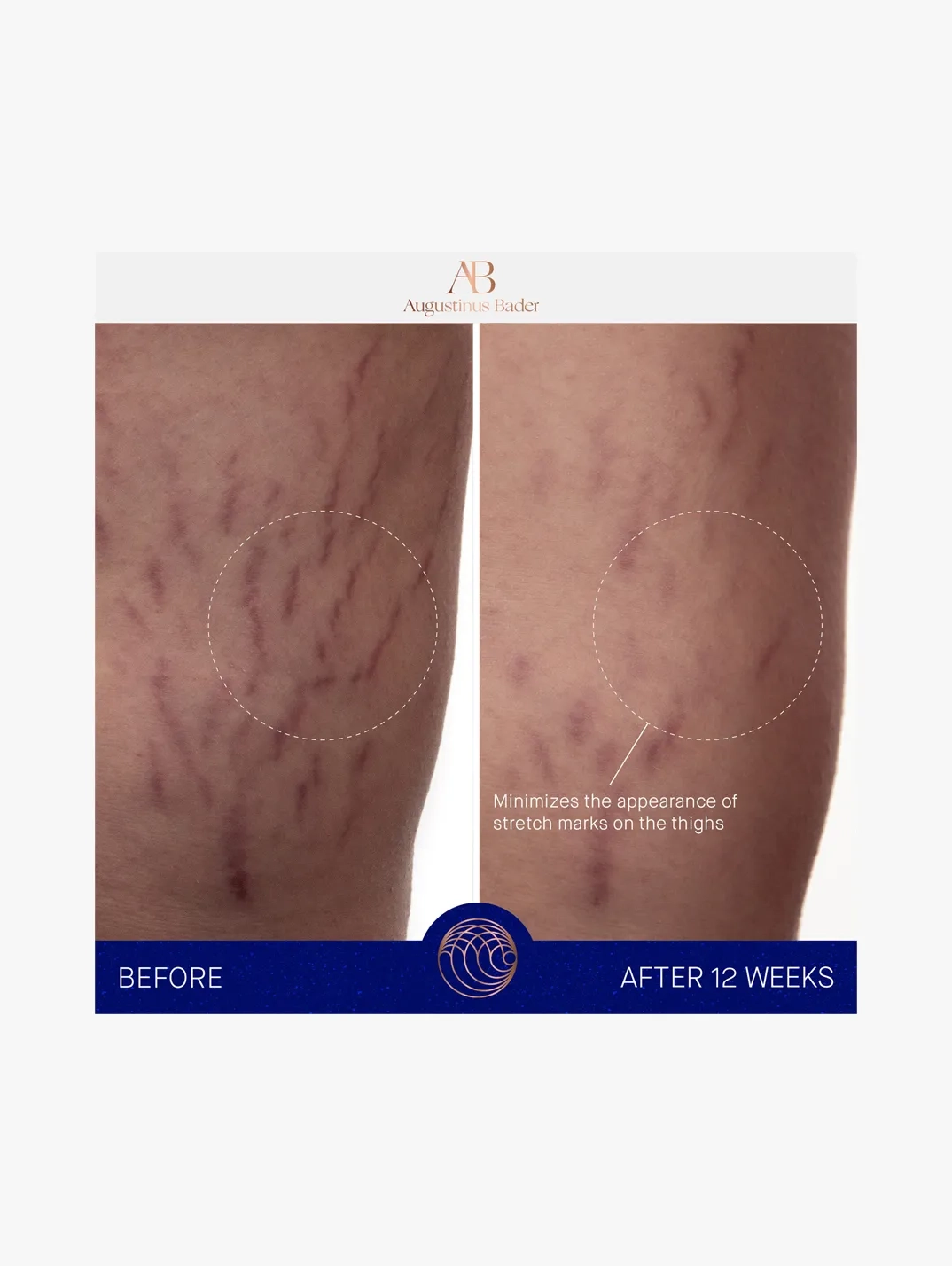 Alternative Image AUGUSTINUSBADERTHEBODYCREAM