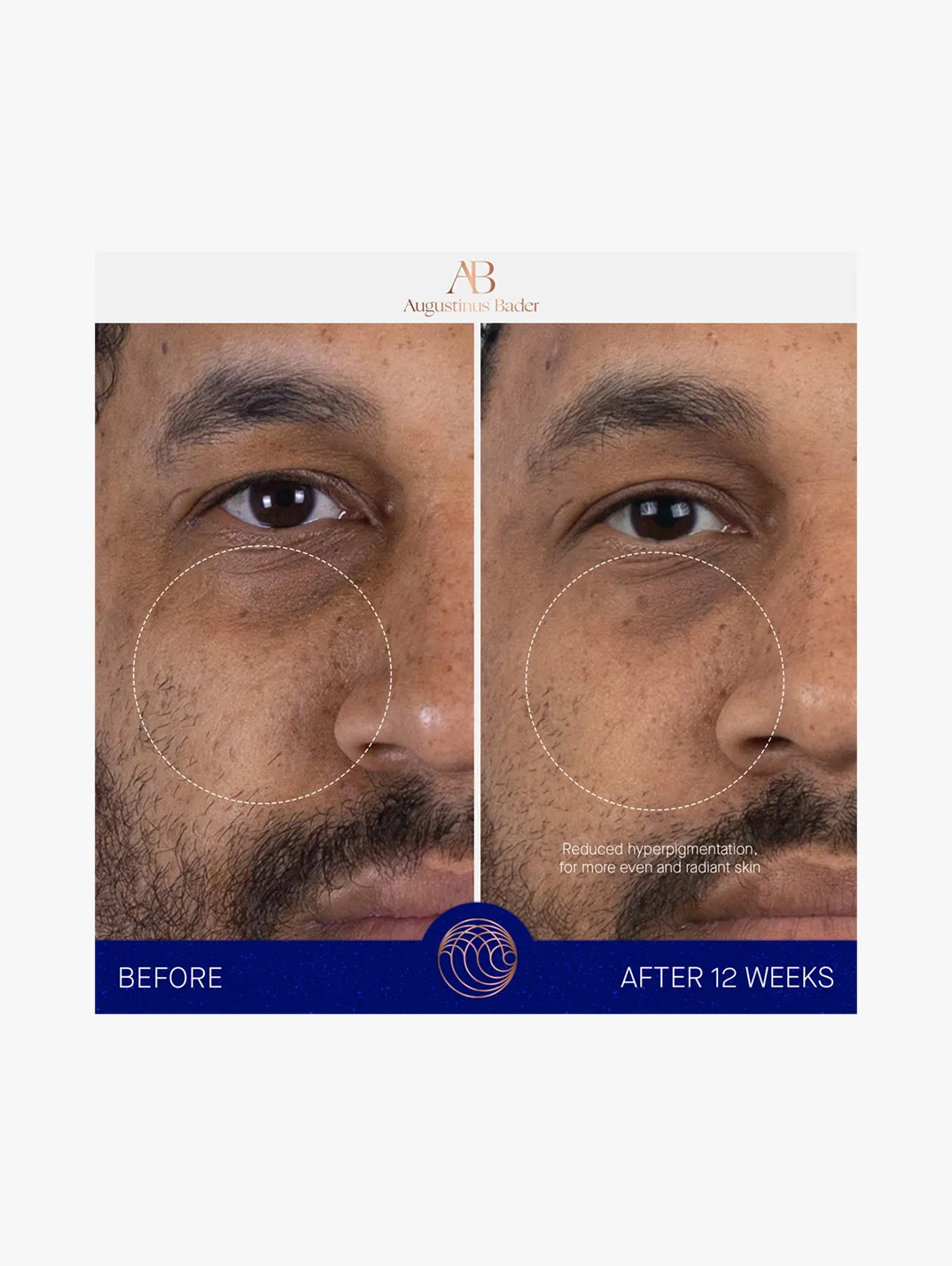 Alternative Image AUGUSTINUSBADERTHESERUM