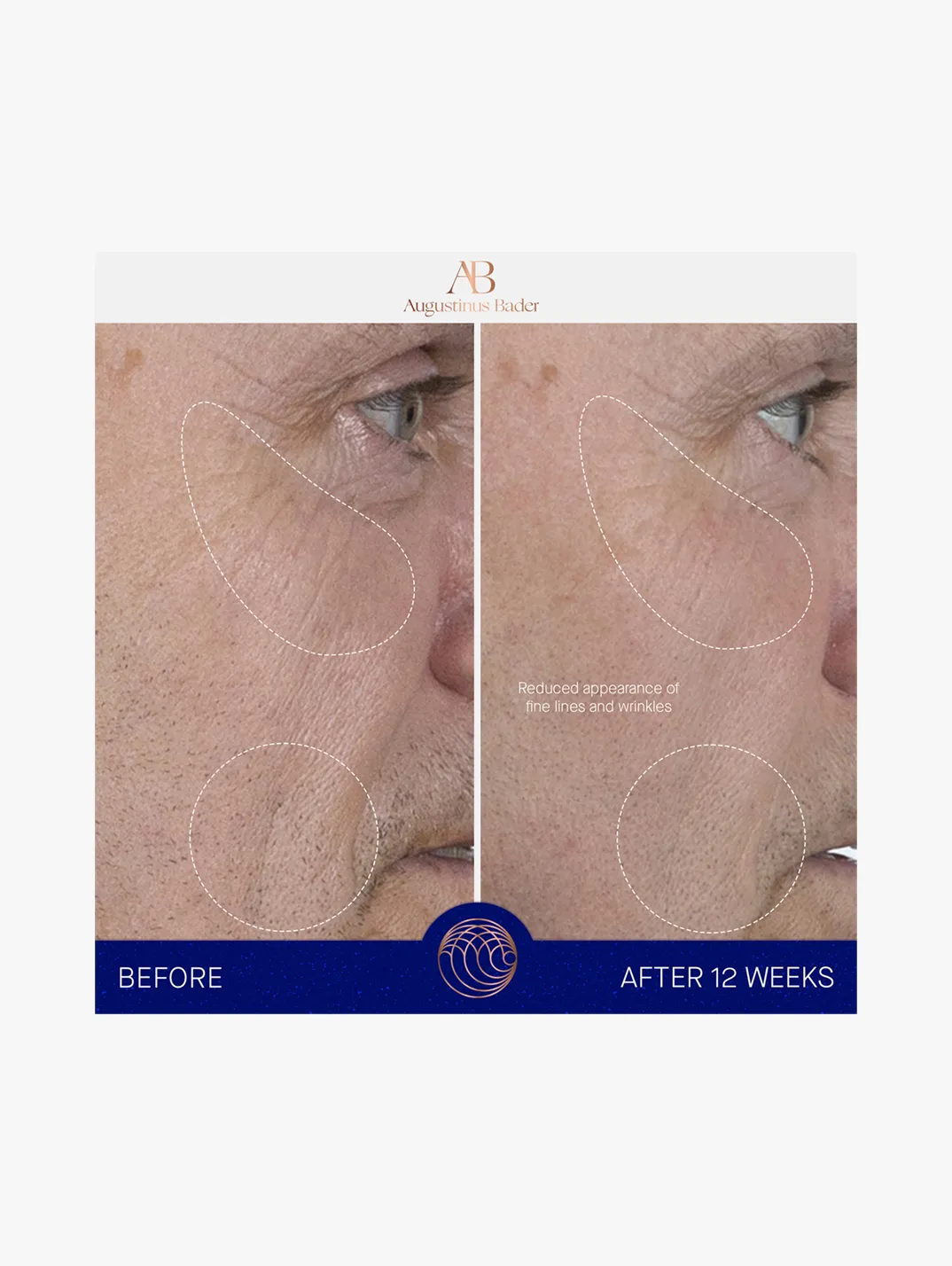 Alternative Image AUGUSTINUSBADERTHESERUM