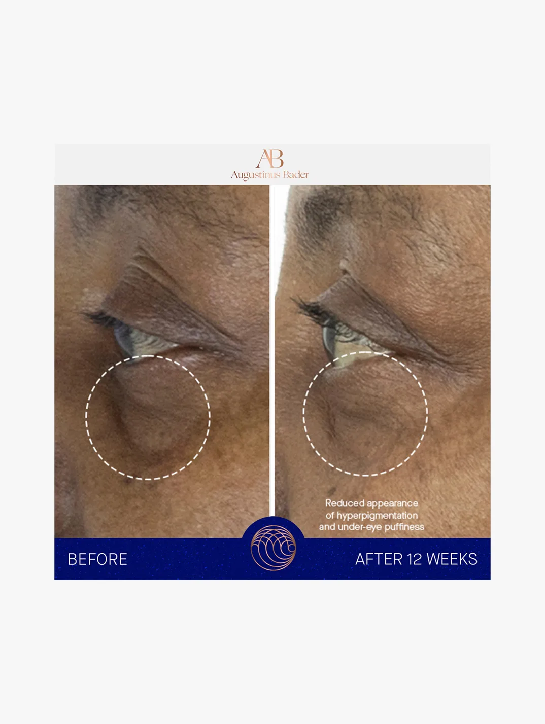 Alternative Image AUGUSTINUSBADERTHEEYECREAM
