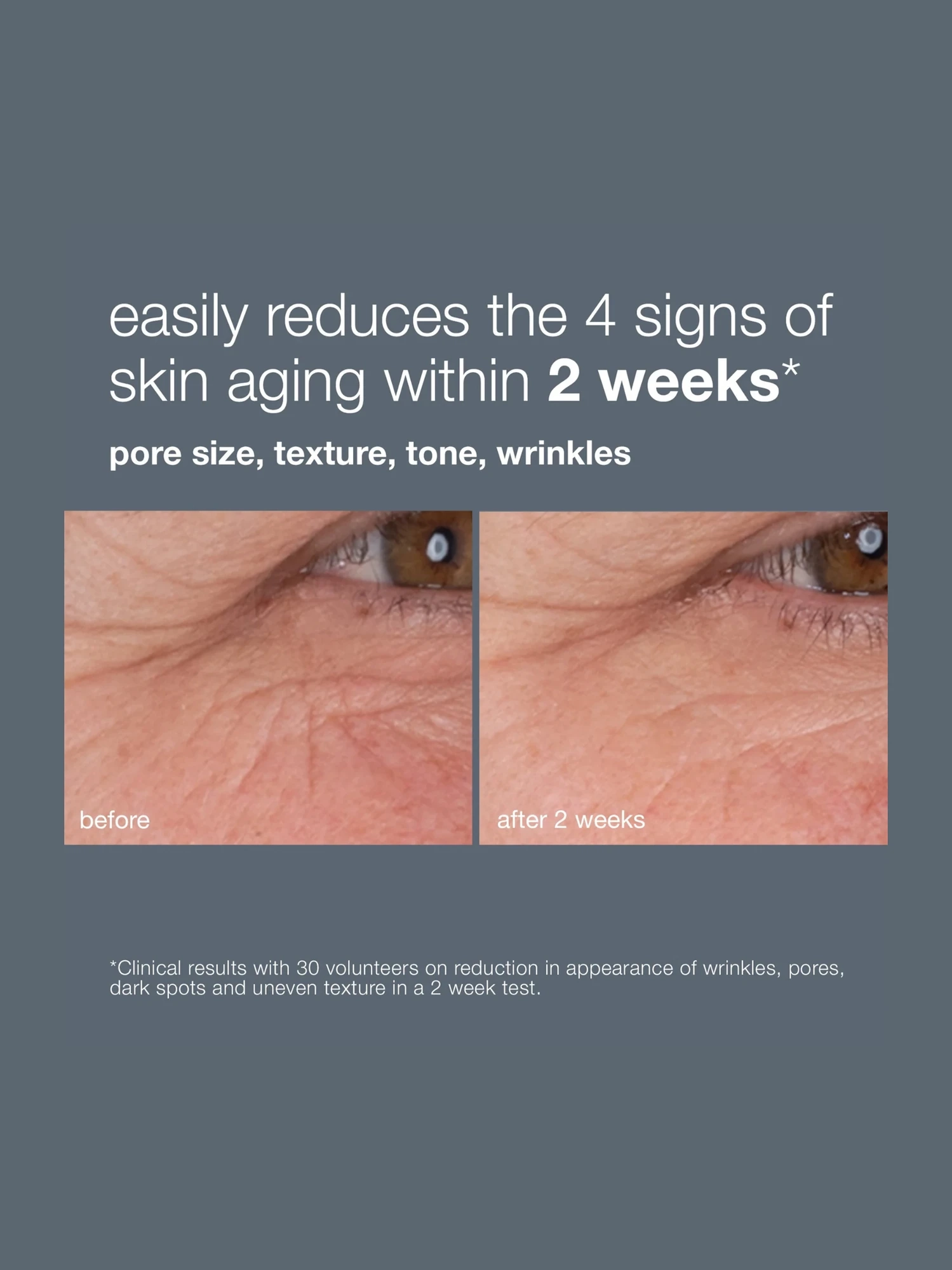 Alternative Image Dermalogica Dynamic Skin Retinol Serum