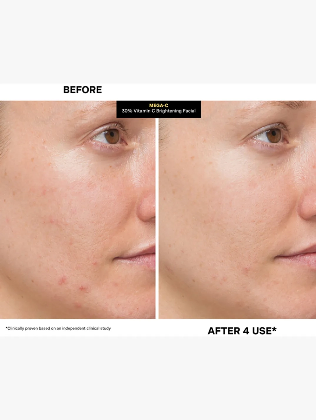 Alternative Image Kate Somerville Mega C30 Vitamin C Brightening Facial