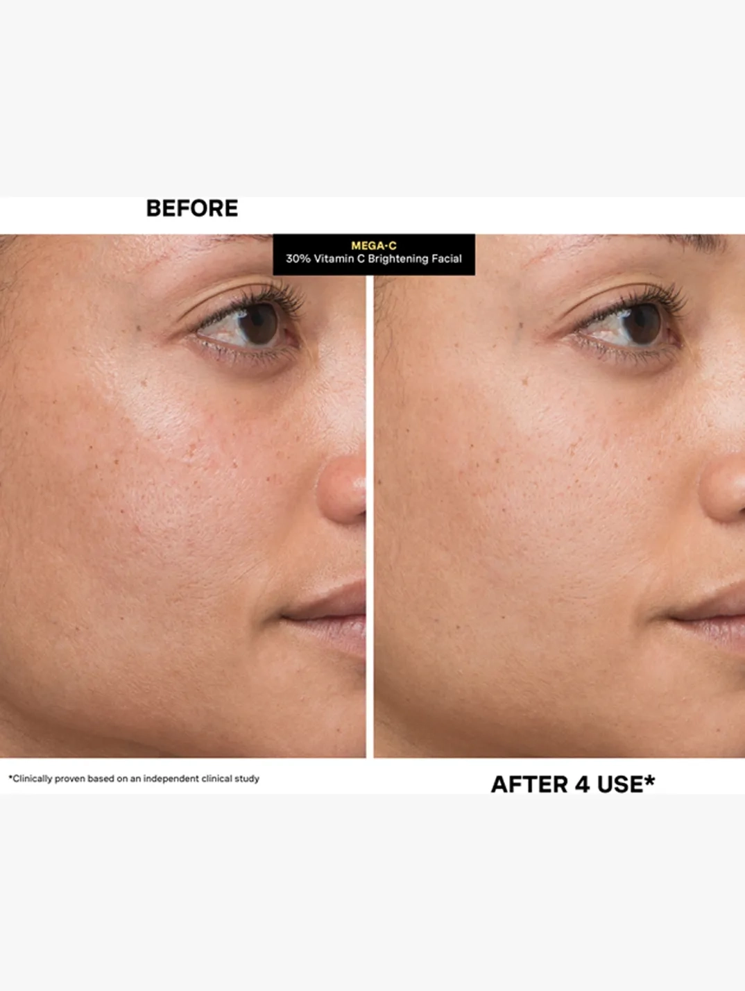 Alternative Image Kate Somerville Mega C30 Vitamin C Brightening Facial