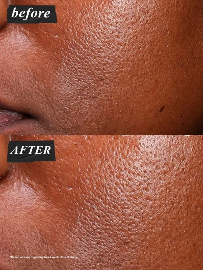 Alternative Image Kiehls Niacinamice Serum 30ml