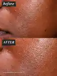 Alternative Image Kiehls Niacinamice Serum 30ml